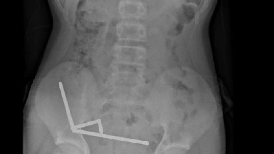 a385de434721921d2a9c146b200ec4e9-reportermt-com