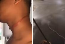 “Quase morri”: motoboy sofre corte no pescoço após ser atingido por fio solto em Cuiabá; veja vídeo