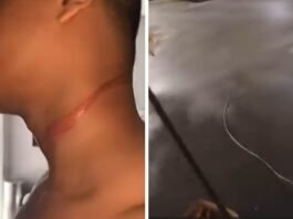 “Quase morri”: motoboy sofre corte no pescoço após ser atingido por fio solto em Cuiabá; veja vídeo